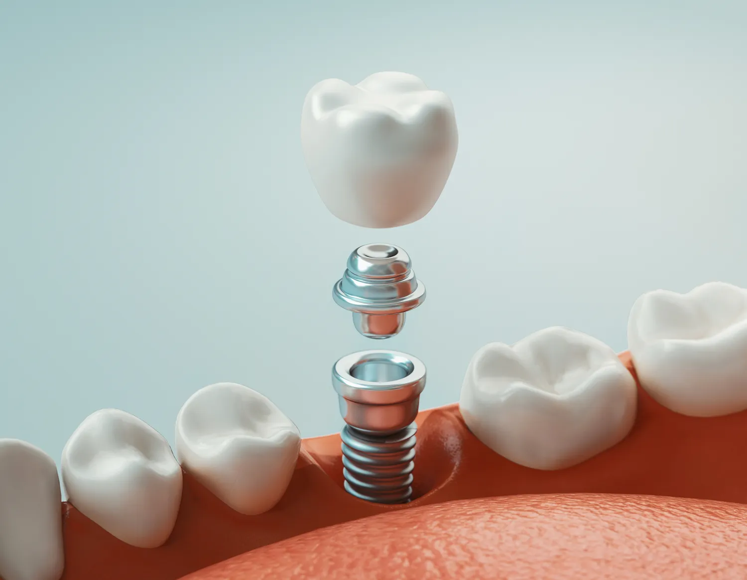 Implanty zębowe Lublin