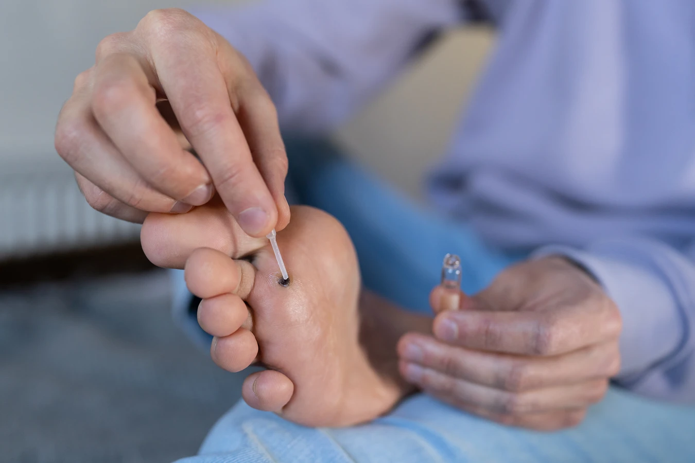 Jak powstają kurzajki?